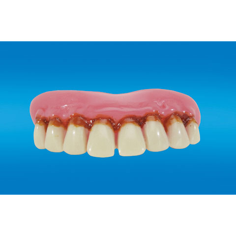 Bb-0036